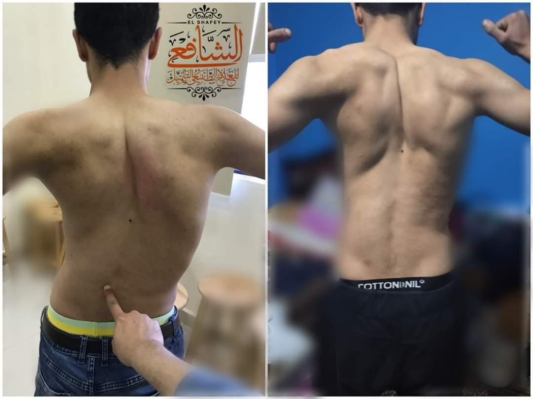 Doc_Mostafa91's tweet image. One of my biggest achievements in my career ❤❤💪