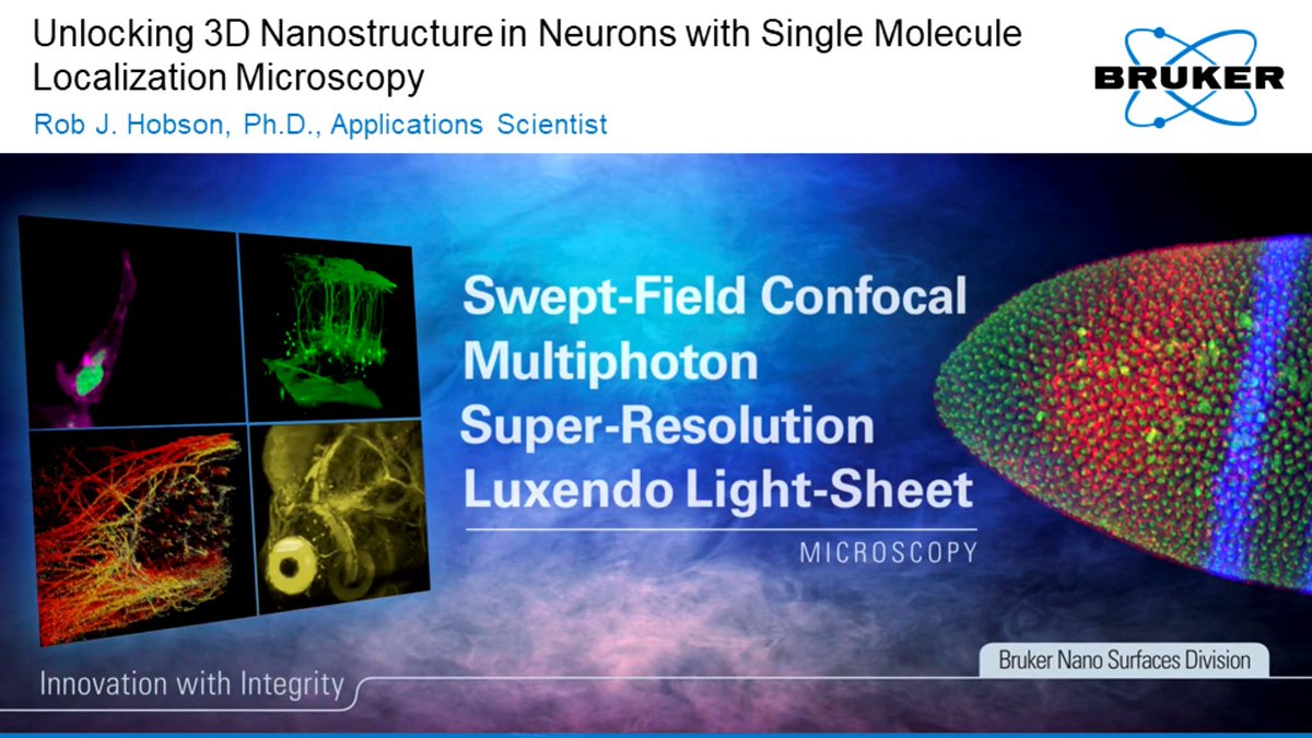 BrukerNano's tweet photo. Rob Hobson, Ph.D. discusses the benefits of Single Molecule Localization #Microscopy and its applications on the convention hall floor at #NEUROSCIENCE 2019.
#fluorescencemicroscopy #singlemoleculelocalization #TBT #SFN19 ๐ https://t.co/HQaEdlfzhw https://t.co/8JTCP4LjOF