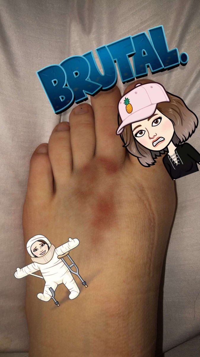 This is how my quarantine is going, how’s yours? #ouch #QuarentineLife #StayHome #COVID19 #HURT #BlameTrump