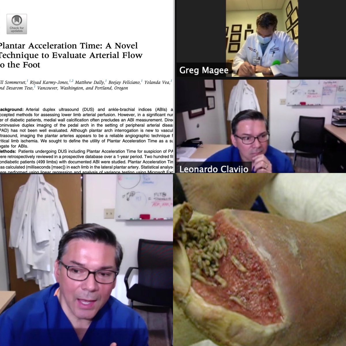 DGArmstrong's tweet photo. Thanks for Tanzim "TK" Khan for leading a great SALSA Case Conference. From plantar acceleration time to...maggots! #ActAgainstAmputation #FightOn #Biosurgery #DiabeticFoot https://t.co/xa94DaI1RJ