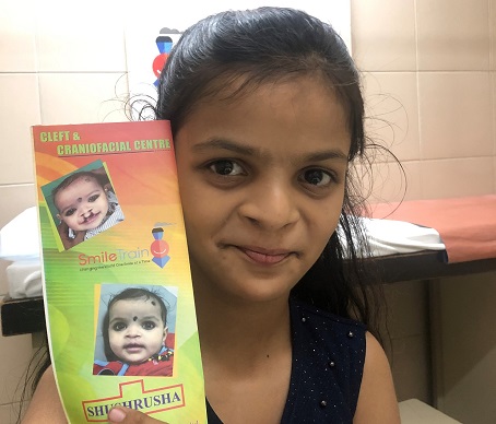 Looking for something to do during the #COVID19 #quarantine? Take up the #givingchallenge to give new #smiles to children with #clefts! Donate now to brighten up someone's day. 🙂 bit.ly/2WZdykA
