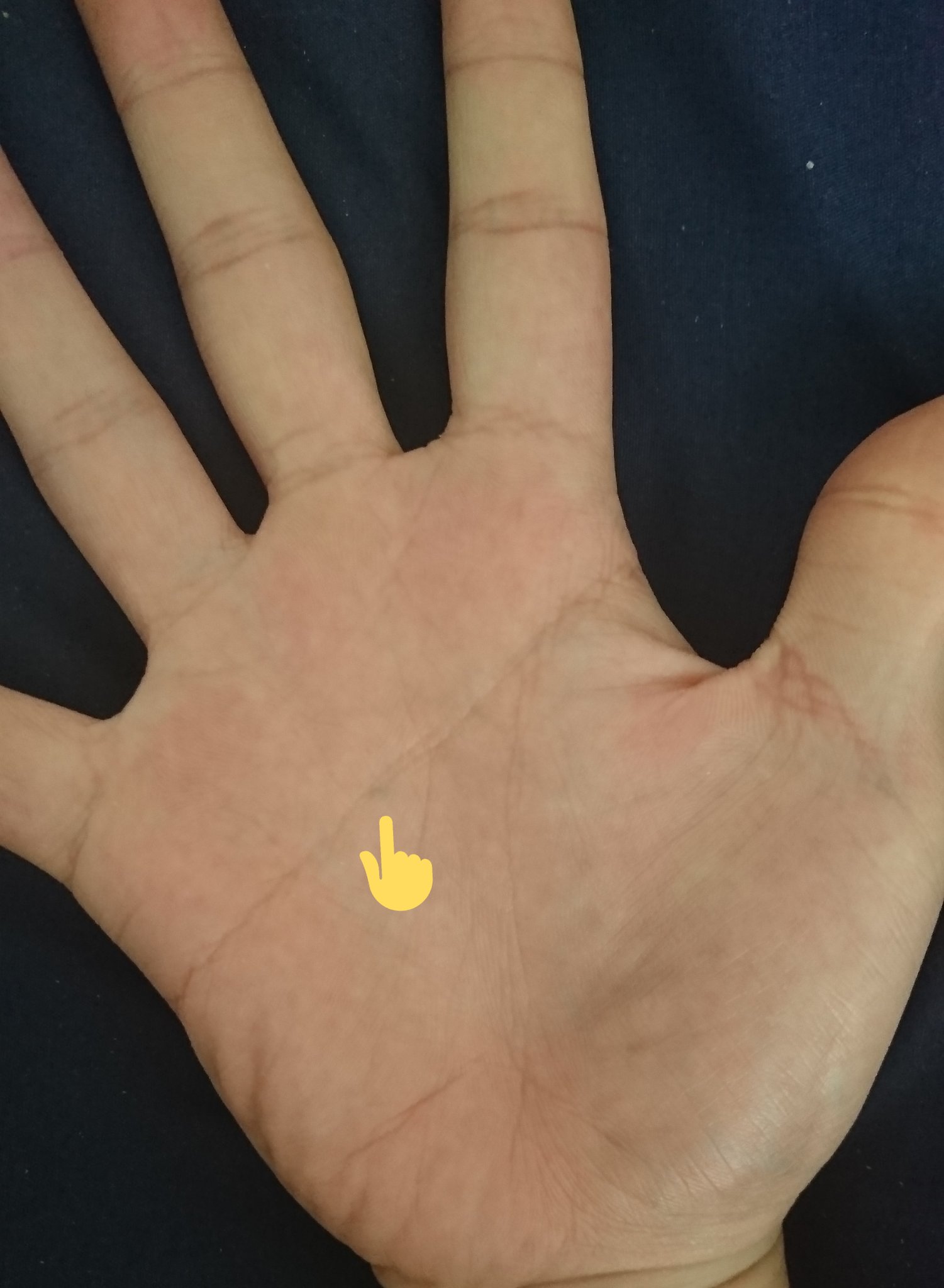 Neneca めちゃめちゃどうでもいい話なんですけど 小3の頃手のひらに鉛筆の芯ぶっ刺さって折れたら手のひらに残ったまま傷が治っちゃって取れなくなったってバグ抱えてて全然もう今は痛くないんだけどなんか泣けるよなっていう報告 T Co Lzaqzufnyu