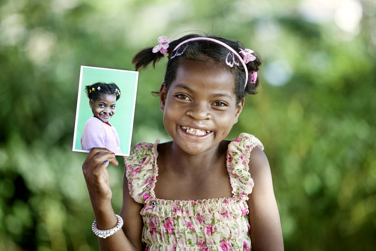 OpSmileSA's tweet photo. Clara was raised by her father Dede. He was heartbroken to see his child suffering. People in their village spoke of Operation Smile. Clara had a chance to regain confidence, go to school, participate and socialise.
Become a #SmilePartner and help children like Clara. https://t.co/jXzGMMxHkd