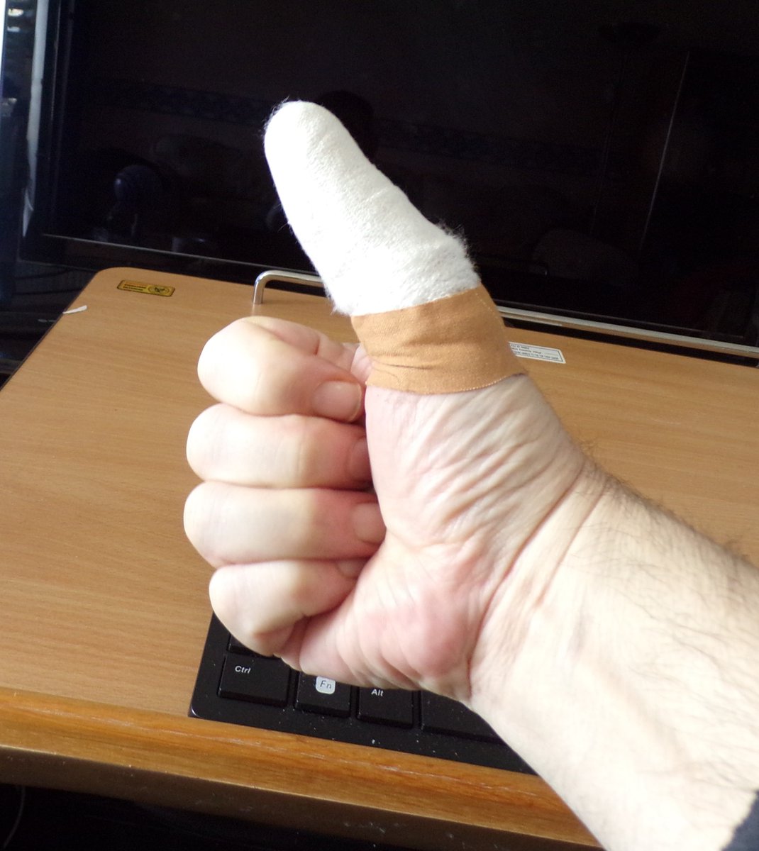 wildmantel's tweet photo. I would like to say that I am enjoying the Wastelanders #Fallout76update, but sadly I am not. ANOTHER MOANER!! NO..  Yesterday I struggled with an infected thumb. After going to the hospital now I hit all the buttons at once. I am more a Fault Boy than a Vault Boy. I can wait. https://t.co/CVVfG8oQ4W
