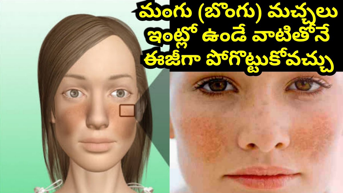 LakshmiCreatio3's tweet photo. Click the link below for video 👇👇
https://t.co/XnNv2YUG7P
మంగు మచ్చలను తొలగించి చర్మాన్ని మృదువుగా కాంతివంతంగా ఉంచే చిట్కాలు
#బ్యూటీ
#beaytytips
#health #beauty  #mangu #pigmentation #Tips #tricks https://t.co/pV8wMJqNg2