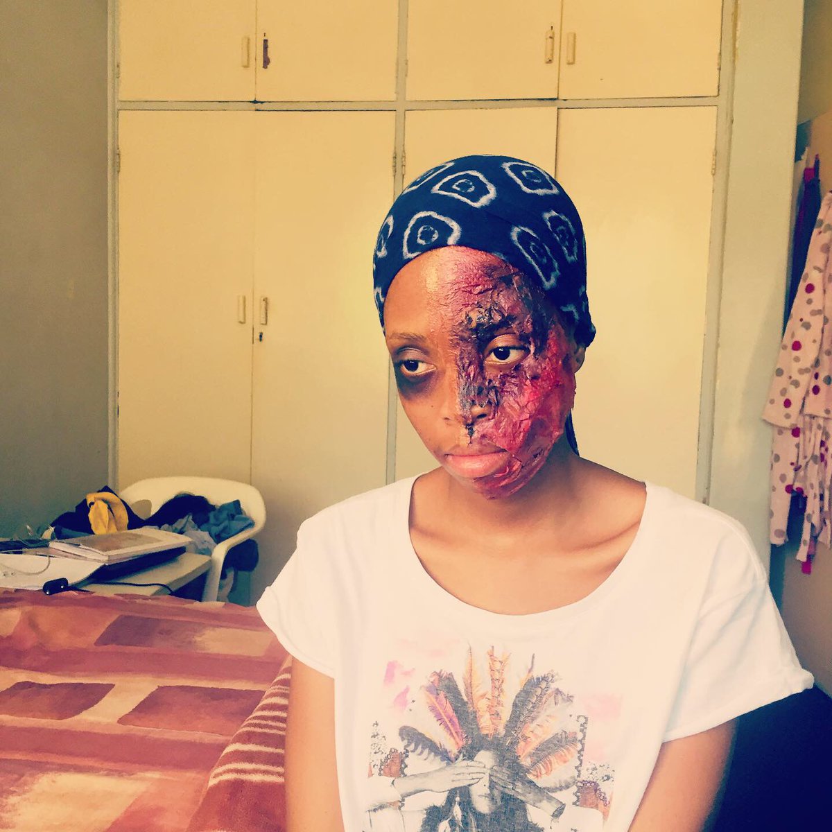 Yellow_Thighs_'s tweet image. A Half Burnt Face Using Makeup🥺🥵
RT for awareness... Maybe I might Get a Job via this😭🙏🏽😅 
RT RT RT Please
#Womandla
#Mbokodos
#GBV