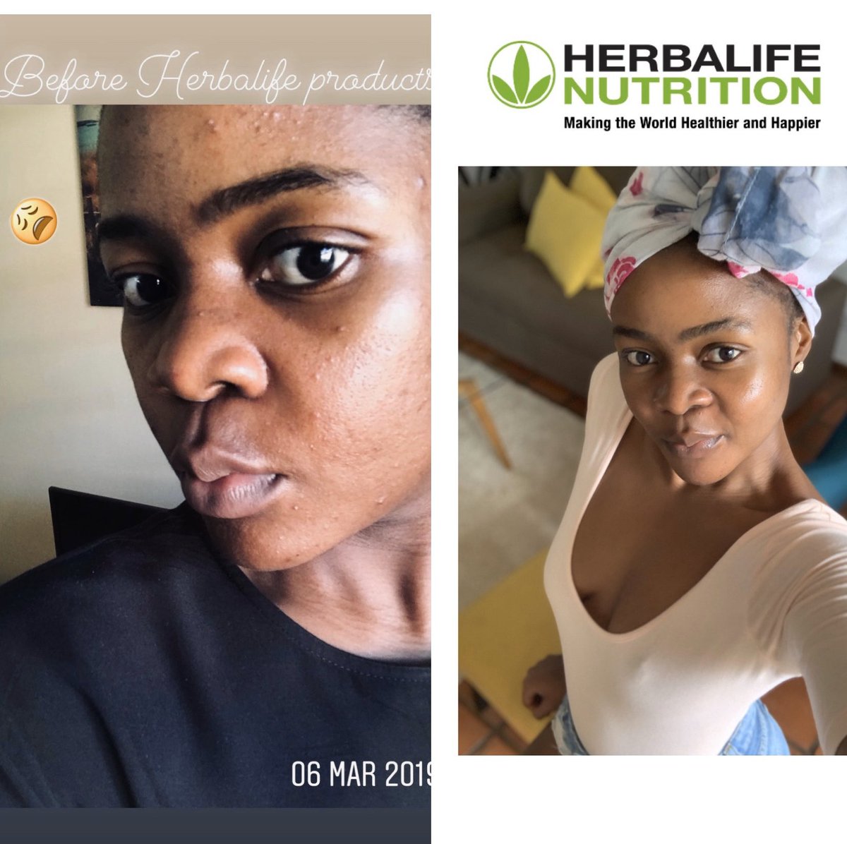 herbalife skin results