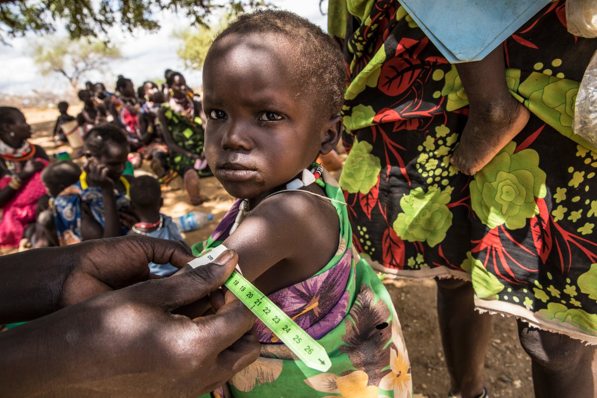 WFP's tweet photo. During a pandemic, malnutrition rates can increase sharply, leading to higher mortality rates, as malnourished people have weaker immune systems and are more susceptible to disease.

#COVID19 Our greatest concern is the impact this can have on the most vulnerable people we serve. https://t.co/ktfnQklsKY
