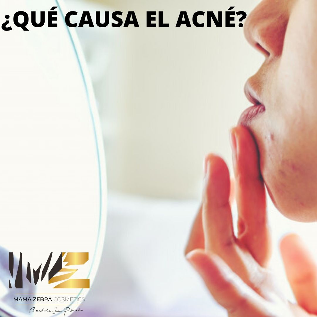 En nuestro nuevo post 📄 os damos algunas claves para combatir el acné y sobre todo, os mandamos mucho ánimo y positivismo 💪😊 
mamazebracosmetics.com/blog/52-que-ca…