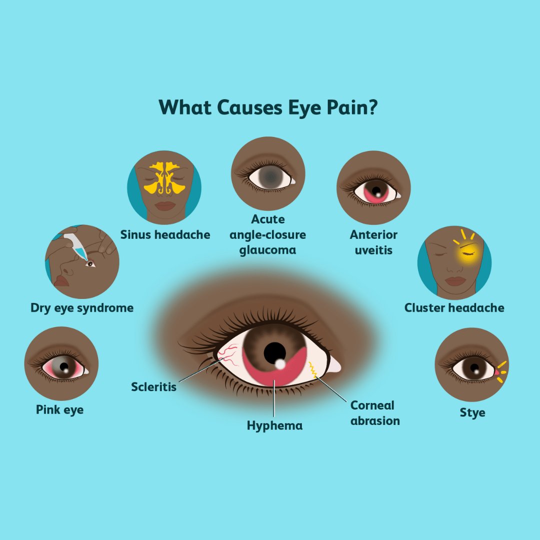 ChildrenOptical's tweet image. Numerous things can cause eye pain or bad vision. After you get your eye exam, walk over and choose your glasses! Corrective lenses will take away all these symptoms. #eyecare #eyepain