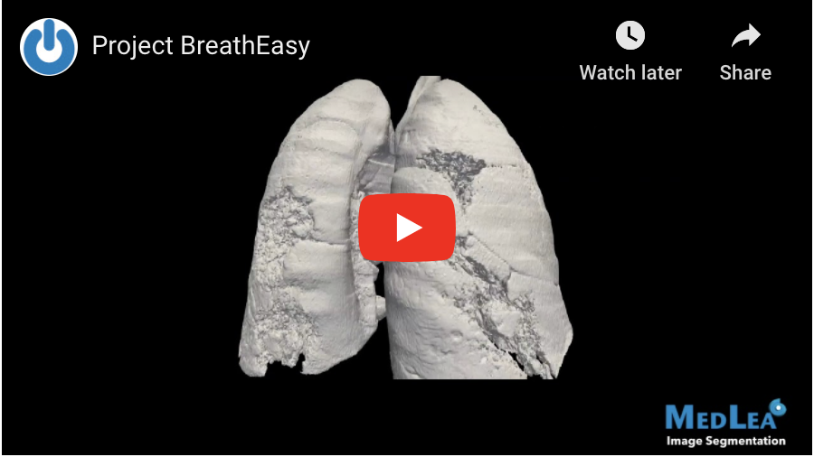 insideHPC's tweet photo. Project BreathEasy using Digital Twins of Lungs to Improve COVID-19 Patient Outcomes

https://t.co/JP4l5ilWUV #HPC #CoronaVirus #OnScale #digitaltwins https://t.co/CF8opTaJlE