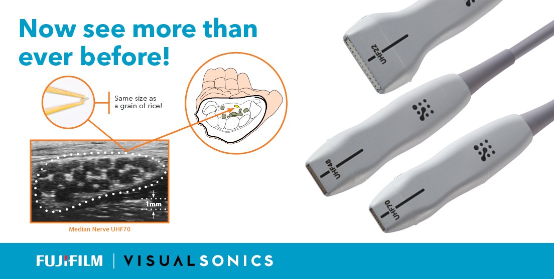 VisualSonics's tweet photo. Whether it's imaging tiny infants, detecting small lesions, or monitoring the subtle changes in blood flow, the #VevoMD provides resolution as fine as half the size of a grain of sand!
To learn more please visit https://t.co/FtZpNidFqk
#ultrahighfrequency #ultrasound #imaging https://t.co/GEj4t7KBry
