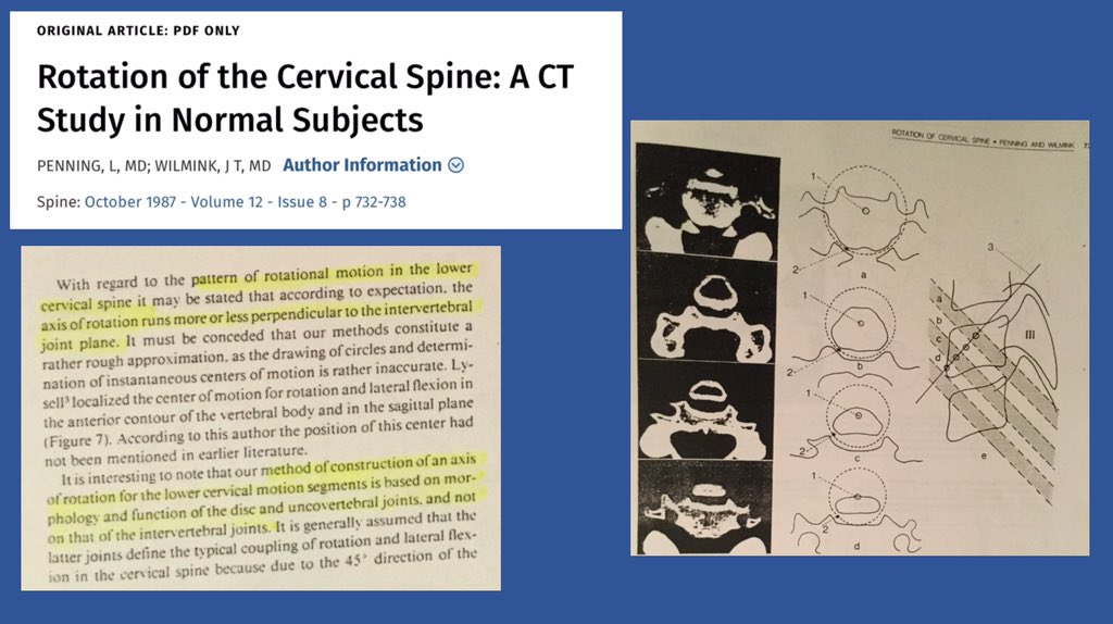 This age related developmental fissuring and formation of the uncovertebral joint ha sheen shown to be important in juvenile torticollis. The joints formation is also important for functional head and neck rotation. Penning showed that the true axis of neck rotation can be mapped