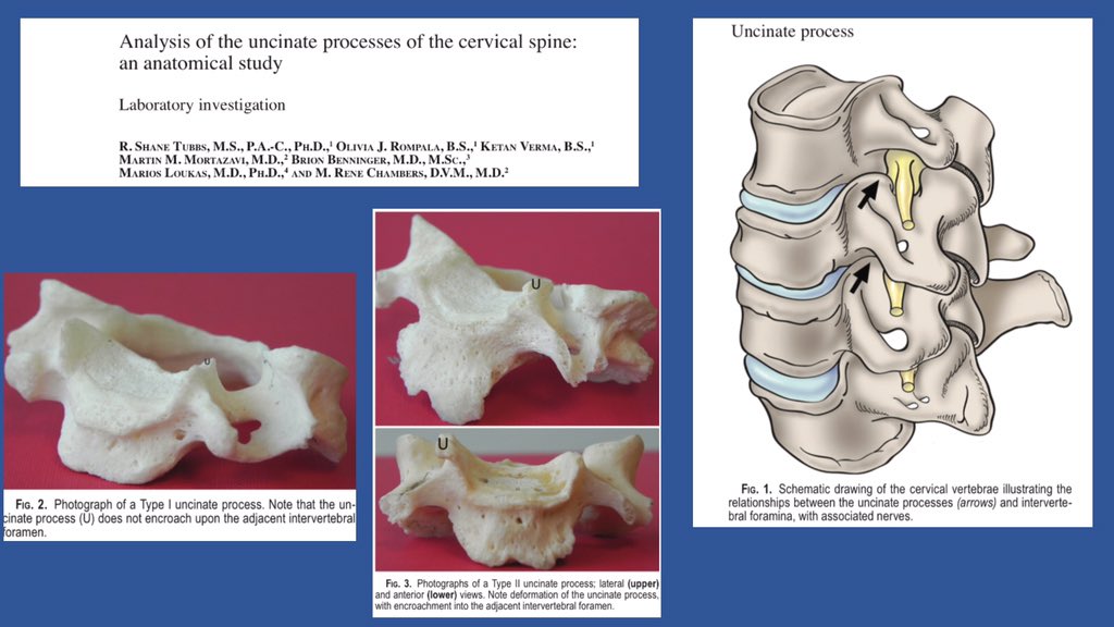 Here is a link to a paper on uncovertebral joint development  https://www.researchgate.net/profile/Martin_Mortazavi/publication/221765535_Analysis_of_the_uncinate_processes_of_the_cervical_spine_An_anatomical_study_-_Laboratory_investigation/links/55fcfa7808aec948c4c0e5bc/Analysis-of-the-uncinate-processes-of-the-cervical-spine-An-anatomical-study-Laboratory-investigation.pdf?origin=publication_detail