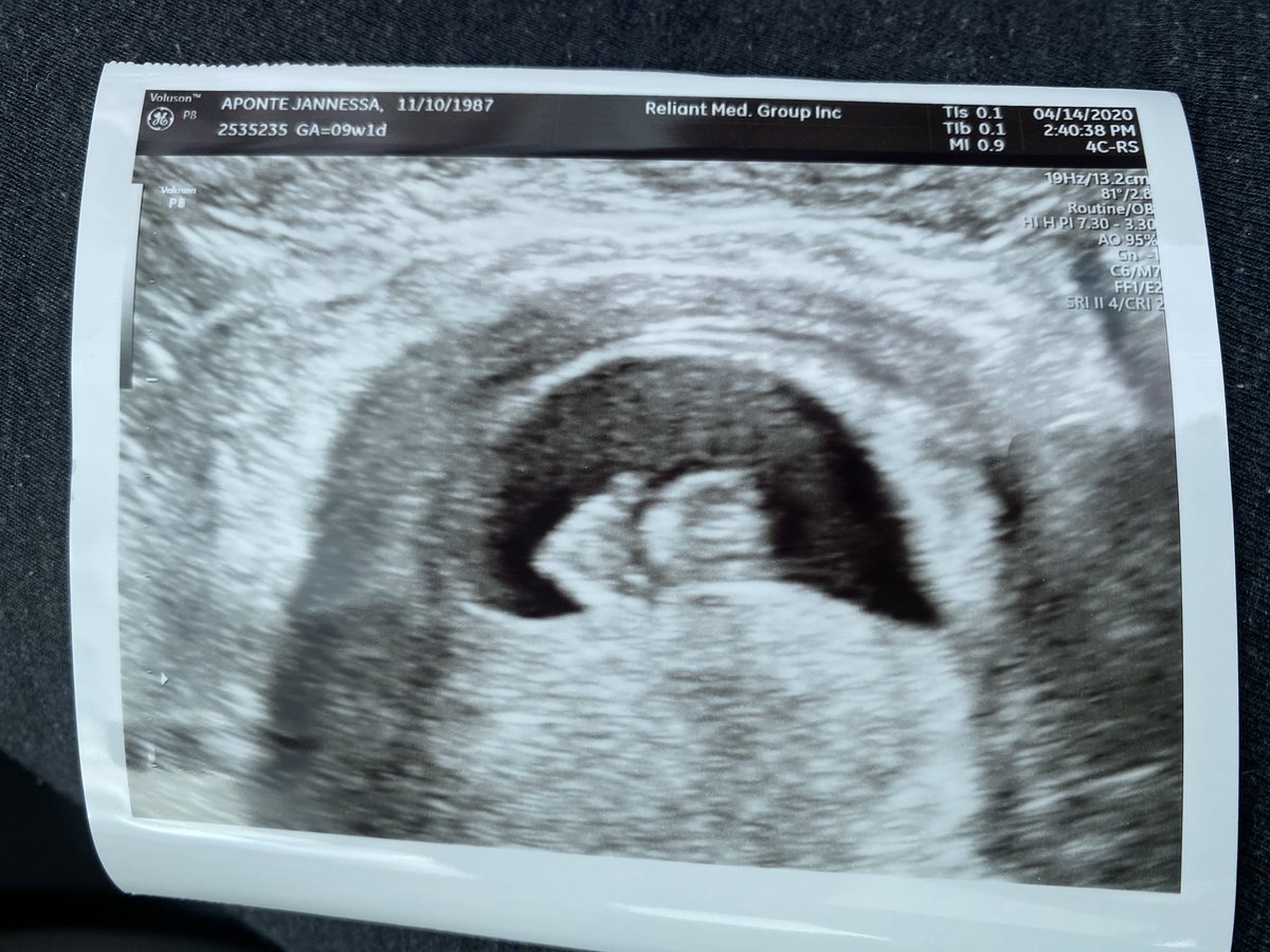 QbGardner06's tweet photo. @pulte Could you help me out. My partner is expecting. $QbGardner06 https://t.co/l2BuFBVley