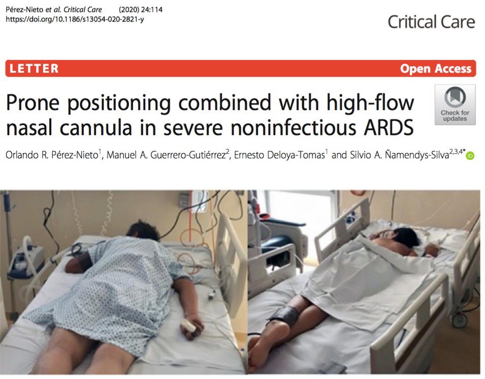 Oxigenation efforts include HFNC (might increase aerosol risk), and awake proning. Awake proning is a promising strategy to avoid intubation. We have been doing this with NRB mask with some success (foto by our ED Head  @doctorthierry). Case series by Ding and  @OrlandoRPN (8)