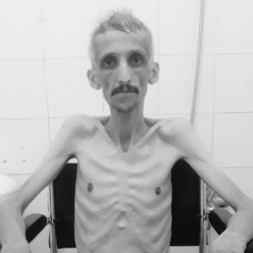 Chp1881_'s tweet image. Joodse gevangenen in een nazi-kamp is niet het Turkije van de 21ste eeuw ik #Grupy die voor de dood van het lichaam heeft betaald is niet toegestaan ​​om vrij lid # ibrahimgokcek lied van de dag-tot-dag oplosmiddel van het beeld spreken.  Het spijt me zo