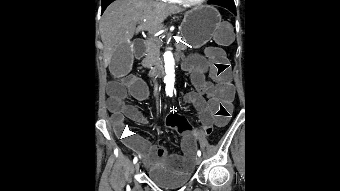 RadioGraphics tweet media