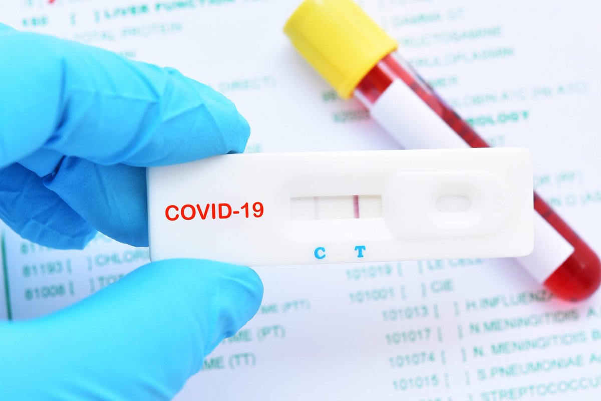 maggieKTVB7's tweet photo. Do you need a COVID-19 test? Do you think you’ve already had the coronavirus? You can get guaranteed access to a COVID-19 test or an antibody test in Idaho as soon as tomorrow. I’ll tell you how on the morning news in the AM on @KTVB. https://t.co/I29gm0bqGx