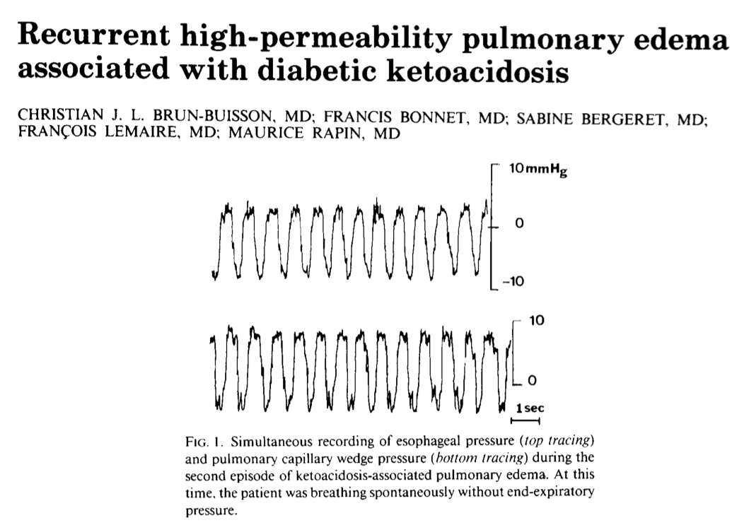 Evidence of P-SILI is weak but plausible. In sheep, infusion of sodium salycilate to the brain causes lung injury and this can be prevented by sedation. There are case reports of patients with DKA developing non cardiogenic pulmonary edema presumably from heavy breathing (11)