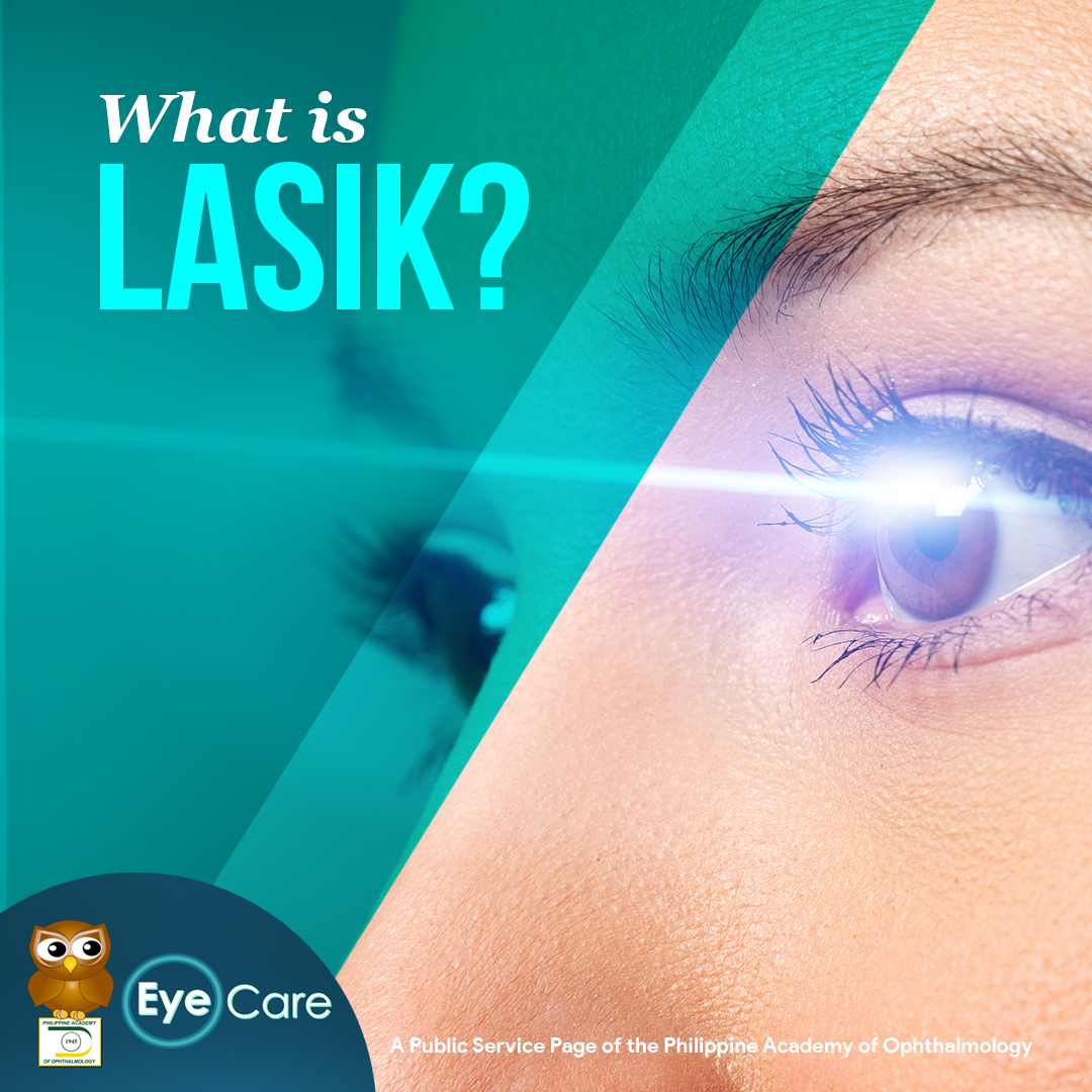 PAOEyeCare's tweet photo. LASIK is a type of surgery that uses a laser to change the shape of your cornea. It is used to treat myopia (nearsightedness), hyperopia (farsightedness) and astigmatism. Talk to an ophthalmologist for more information about LASIK. #EyeCare #youreyecareauthority #LASIK https://t.co/PjnJ6GX2G0