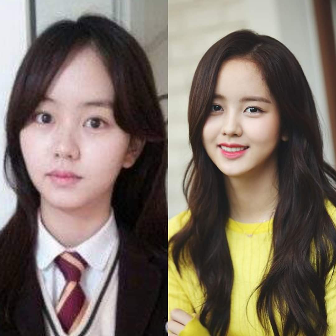 — #KimSohyun