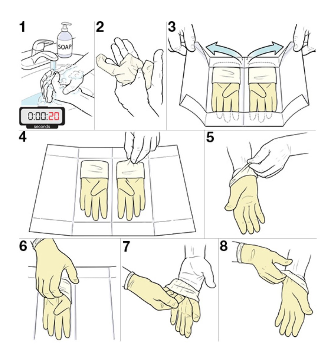 Алгоритм стерильных перчаток. Одевание и снятие стерильных перчаток алгоритм. Схема надевания стерильных перчаток. Одевание стерильных перчаток алгоритм. Техника одевания стерильных перчаток алгоритм.