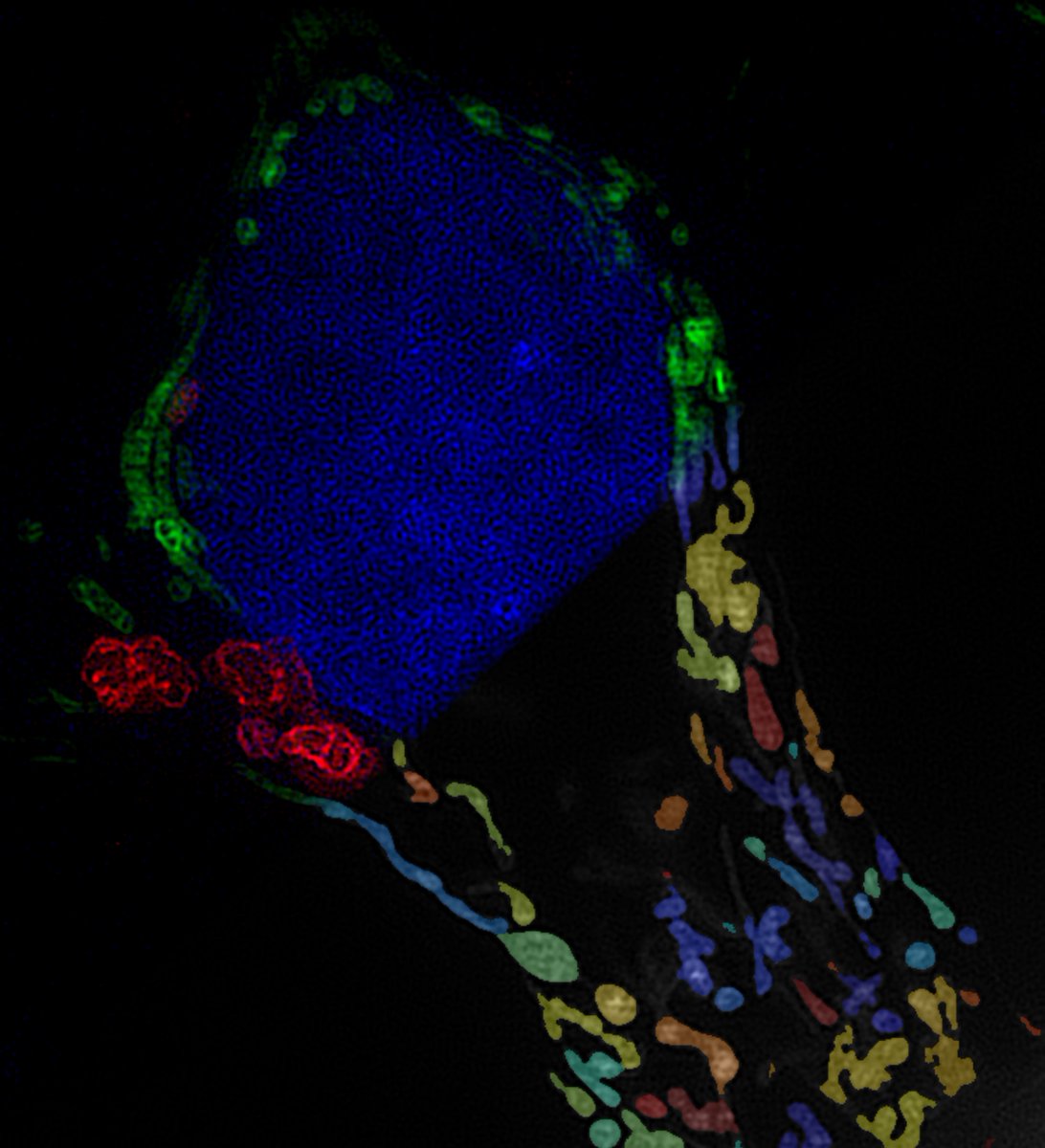 gomobel's tweet photo. Mitochondria – the organelles that power cells – often sit at the centre of changes that lead to a cell becoming cancerous.

Now, @MOFCambridge has created a MOF that targets drug delivery directly to mitochondria.

Read more: https://t.co/qsWZ0z0zHf

@J_A_C_S @ACSPublications https://t.co/y7SVoygn3v