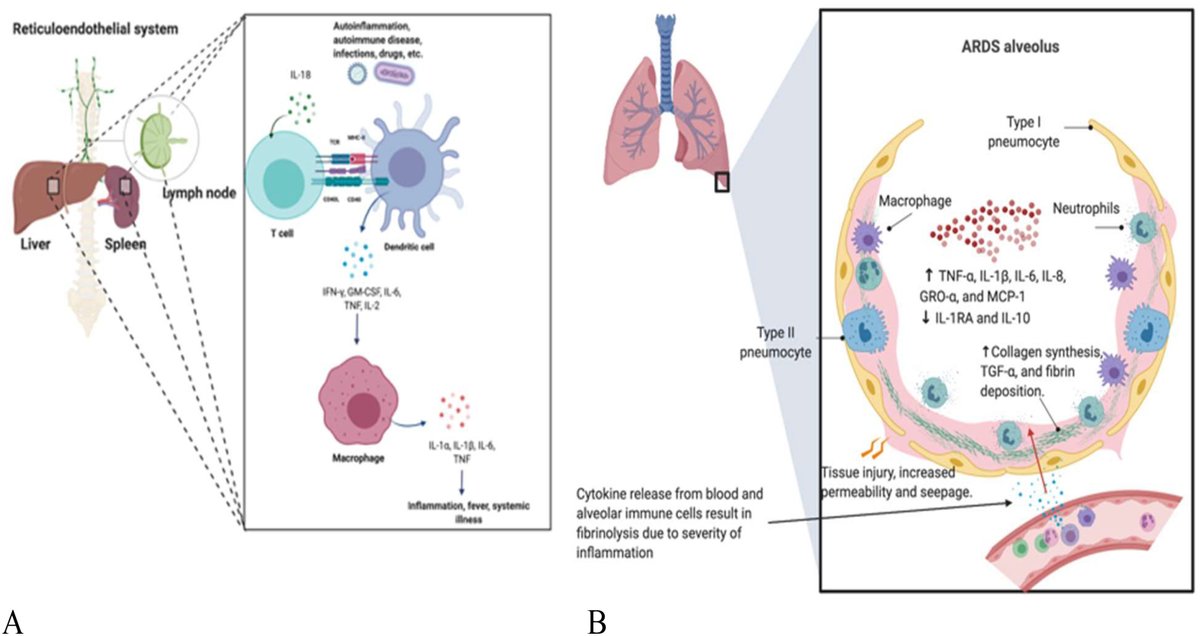 Thus, viral-mediated lymphocyte destruction may contribute to the HLH-like phenotype: T and B-cells = blunted humoral response:Ab titers->  sub-neutralizing antibody response ->  viremia Negative feedback + viremia --> M1 hyperactivation https://www.sciencedirect.com/science/article/pii/S1568997220300926#f0005