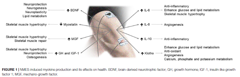 HeliosPareja's tweet photo. Electroestimulación neuromuscular💪como potencial mimético/complemento al #ejercicio durante el #confinamiento por #COVID19 #QuedateEnCasa. ▶️Accede a nuestra revisión con @sergiolpezlpez @carlosromero86 @Fabiansango N.Maffulli G.Lippi https://t.co/MCM0Gddu8s  #EENM #NMES #Salud https://t.co/Rc0jIAiK45