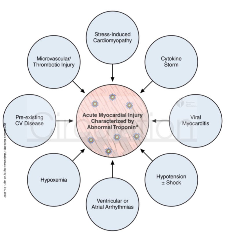 netta_doc's tweet image. Review of #COVID19 CV involvement &amp;amp; proprosed mgmnt in @CircAHA:

“patients w COVID-19 &amp;amp; myocardial injury whom are hemodynamically &amp;amp; electrophysiologically stable w mild-mod ⬆️ troponin should not routinely undergo TTE, angiography or cardiac imaging.” 

#cardiotwitter #EPeeps