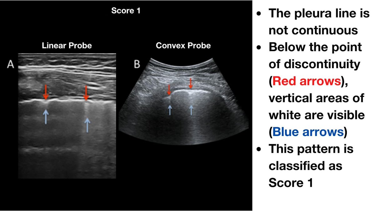 Radiology Rounds (@RoundsRadiology) / Posts / X