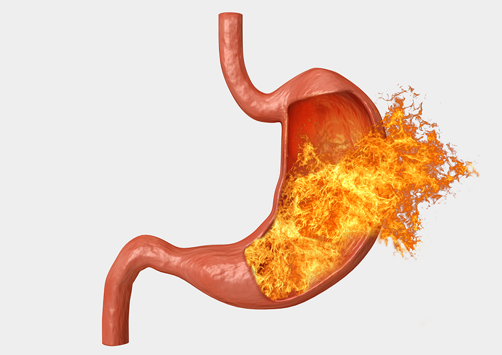 Alimentación en gastritis