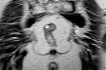 gastroentrolog2's tweet photo. #Defecography is a type of medical radiological imaging in which the mechanics of a patient's defecation are visualized in real time using a fluoroscope. The anatomy and function of the anorectum and pelvic floor can be dynamically studied at various stages during defecation. https://t.co/o2FrW92xl7