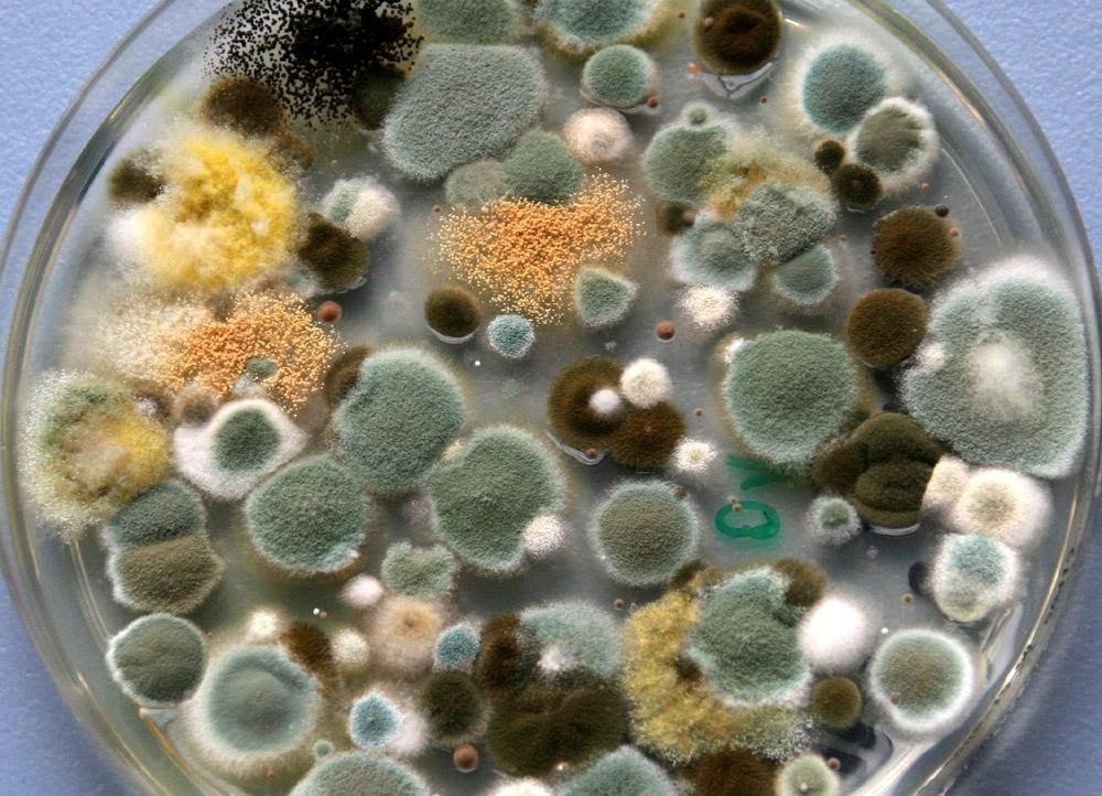 This includes almost all fungi (though not yeast, which remains single-celled and doesn't grow into filaments). But all the rest of it that does grow into mould is a little hard to tell apart at a glance. (At least for people who don't grow plates like this normally!)