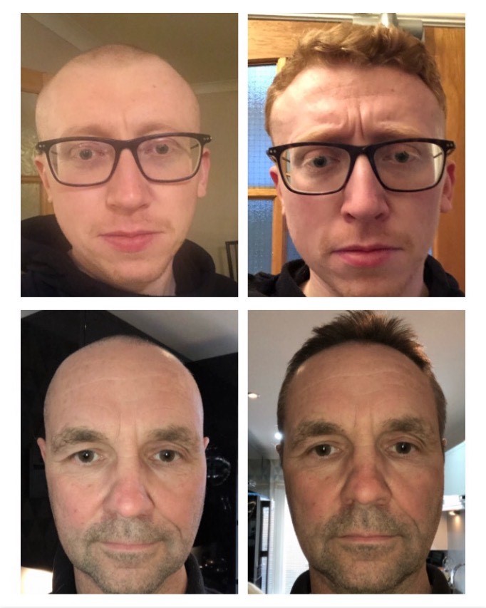 Braving the shave to raise money to support their local #NHS Trust in the provision of vital equipment and resources, the guys have smashed their target but there's still time to donate if you would like 2/2. #Donate #Charity #COVID19 #Community justgiving.com/crowdfunding/h…