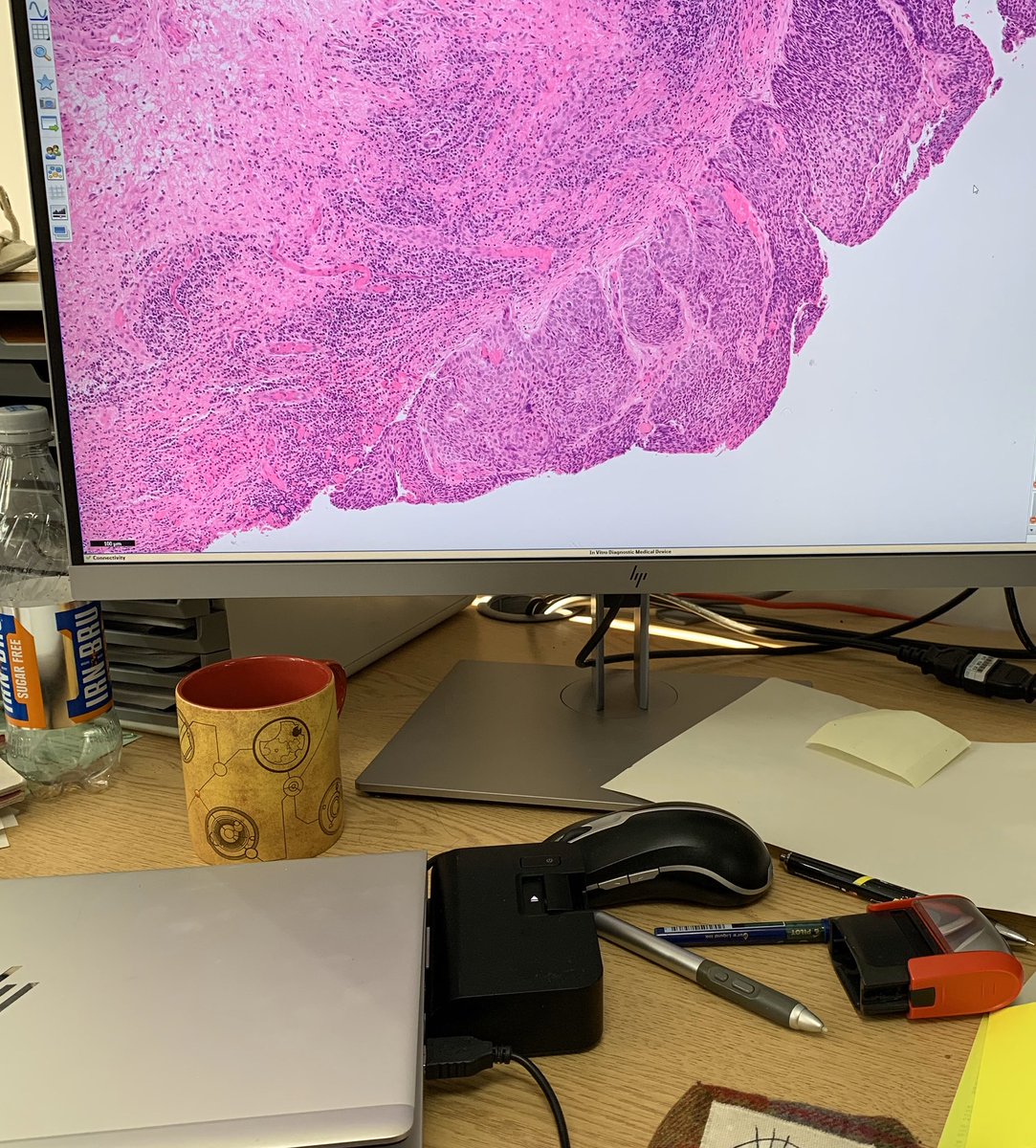 cottrell_lorna's tweet image. So excited to be reviewing digital cases for my MDT tomorrow. Looking forward to torturing the urologists with digital slides at my virtual MDT tomorrow on teams. Welcome to the future! @NHSaaa #DigitalPathology