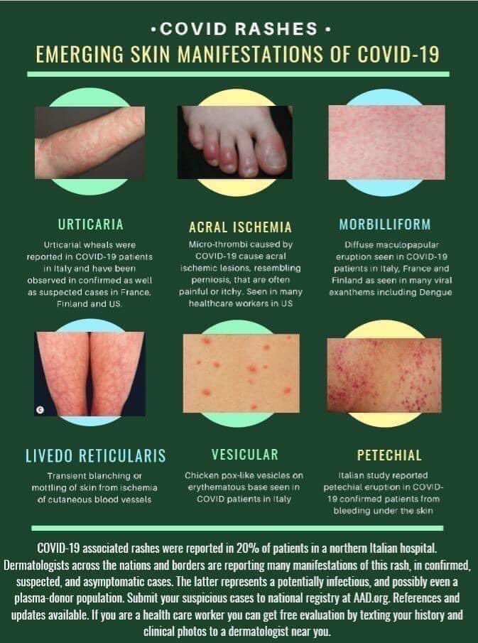 JosephMerolaMD's tweet photo. Shared by Peter Lio on social media;  good summary of (potential) Covid manifestations in the skin #covidtoes #covidskin https://t.co/XkbYr4J1Am