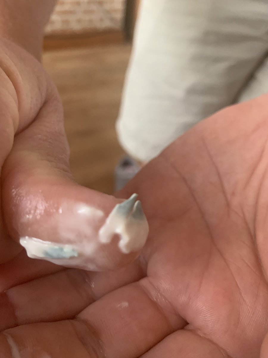 AimeeTunney's tweet photo. @AldiUK any particular reason for my yoghurts being like this..... https://t.co/bqHLxMqyUg