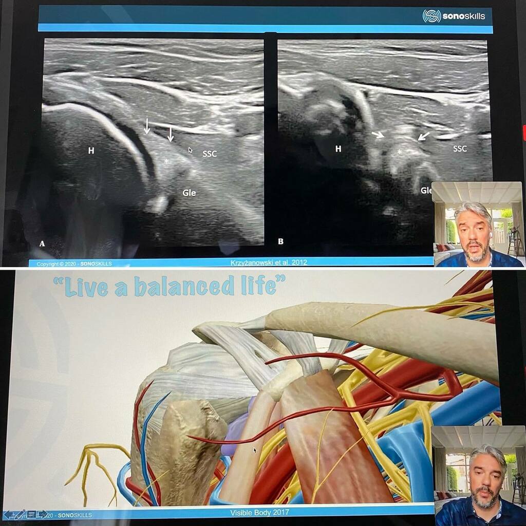 Fysiobalance's tweet photo. Tijdens het thuis blijven op de hoogte blijven over echografie! 
#webinarechografie #sonosskill #fysiotherapie #fysiobalance #liveabalancedlife #blijfscherp #blijfthuis #blijffit #blijfgezond #stayeducated #blijfleren https://t.co/eLeWoqlJ5Y https://t.co/jD8vEIEaUT