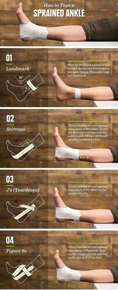 Ankle Sprain 
Taping Technique
The symptoms of ankle sprains and strains can be quite similar, but there are some important distinctions. Both involve localized pain, ankle swelling, and instability.