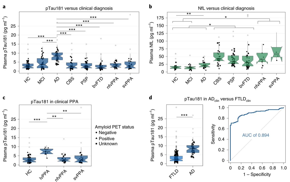 UCSFmac's tweet image. Diagnostic value of plasma phosphorylated tau181 in Alzheimer’s disease and frontotemporal lobar degeneration. Plasma pTau181 identified amyloid β-PET-+ individuals. go.nature.com/2TYF4eG @EHThijssen @relajoie @leoiacca @SalvoSpinaSF @grinberg_t @RabLab_UCSF @JulioCRojas10