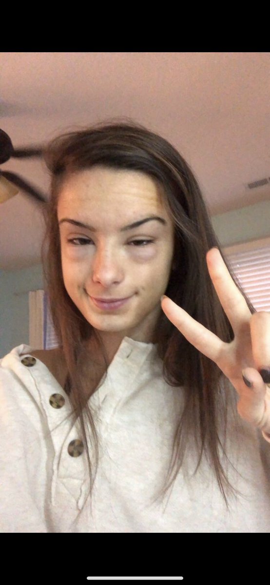 thekillaz_'s tweet photo. Alex Depsa
💣Prone to eye swelling
💣Will mention her totaled volvo to everyone she meets
💣Overly attached to her webkinz Rosy https://t.co/3sR4Z3tVqO