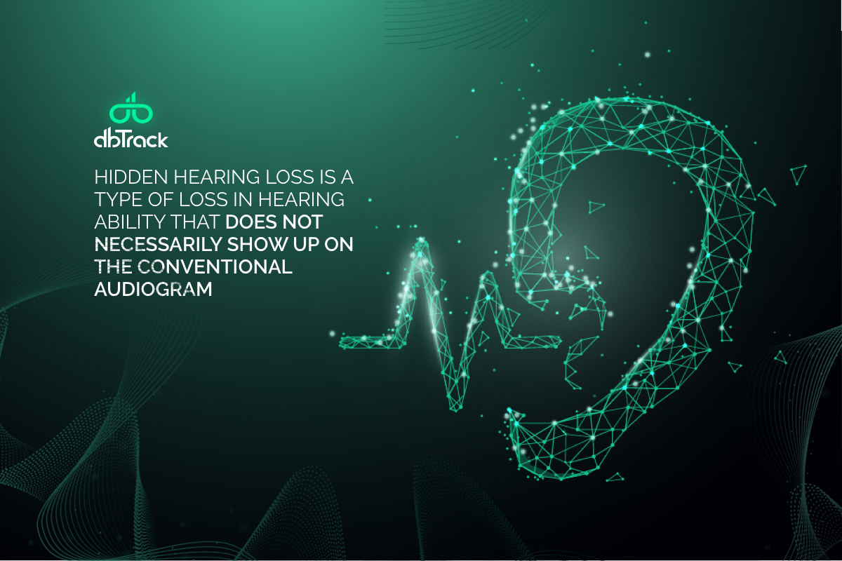 dbTrackApp's tweet photo. #DidYouKnow
#dbTrack #YourMusicYourWay #SafeListening https://t.co/SsOx8VLfVO