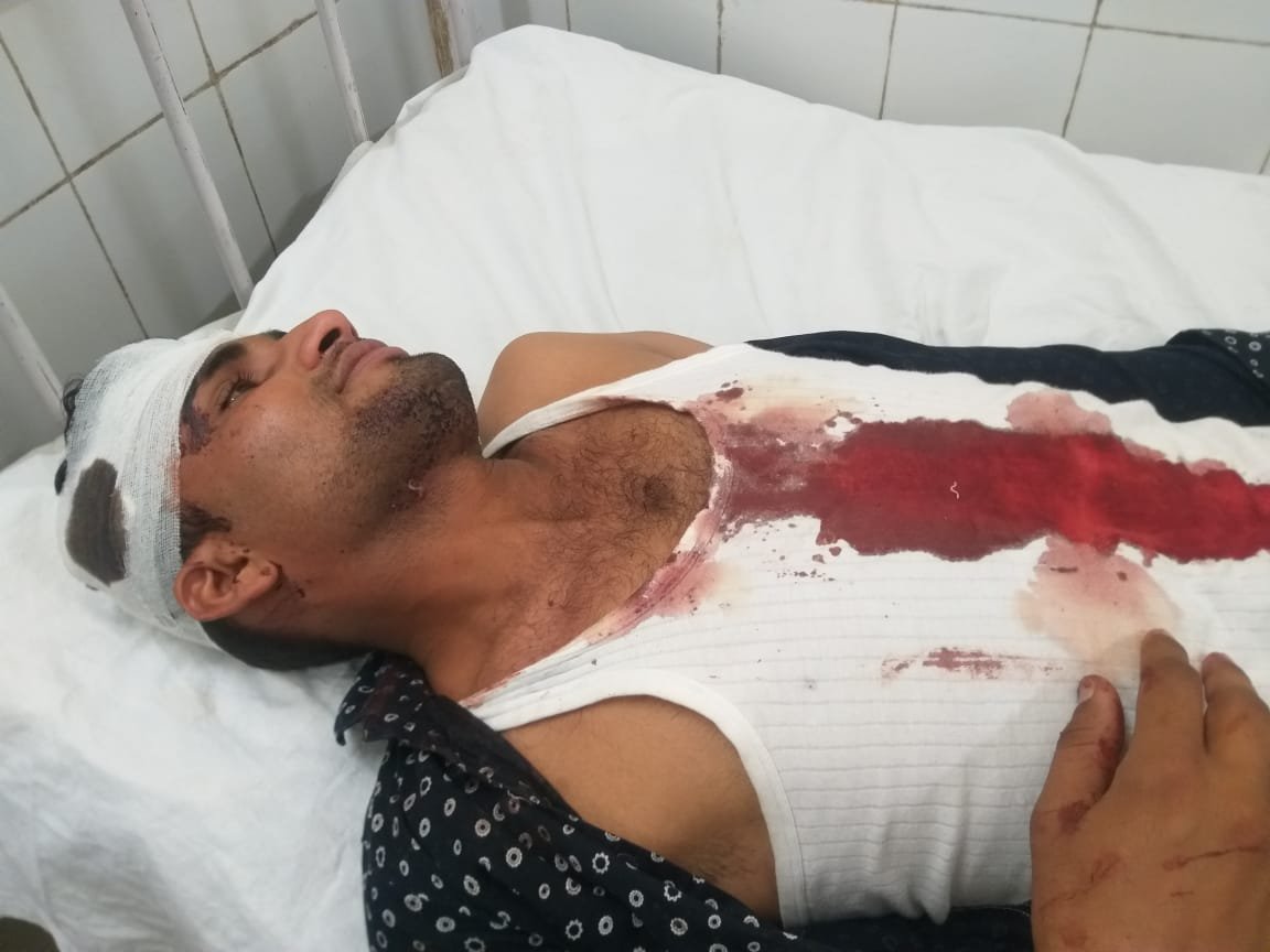 Every attack will be documented.Policemen attacked with rods, swords and stones when they went for survey in  #coronavirus affected minority area. 3 Policemen injured. (Part 2)Date April 17, 2020Location: Tonk, Rajasthan