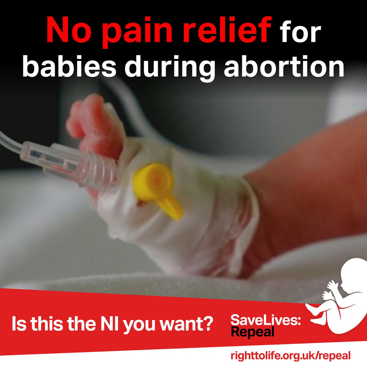 RightToLifeUK's tweet photo. No pain relief for babies during abortion! Is this the NI you want? 

Save lives! Tell your MLAs to repeal the extreme abortion law set to be imposed next week. #SaveLivesRepeal https://t.co/KkjnakdHkS