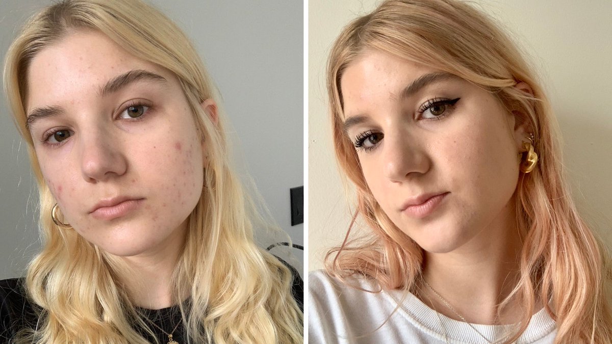 glamour_fashion's tweet photo. Self-Isolating Has Totally Changed My Relationship With Makeup https://t.co/o0ahXba42G https://t.co/1GcfvCzBLb