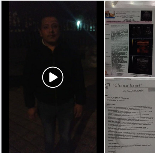 Ausencio Diego García, hermano de un sobreviviente de la noche de Iguala ayer fue diagnosticado con apéndice reventado, se encuentra ingresado en urgencias del hospital general de Chilpancingo y NO Ha sido operado.
Exigimos se atienda URGENTEMENTE Video: facebook.com/10001337283269…