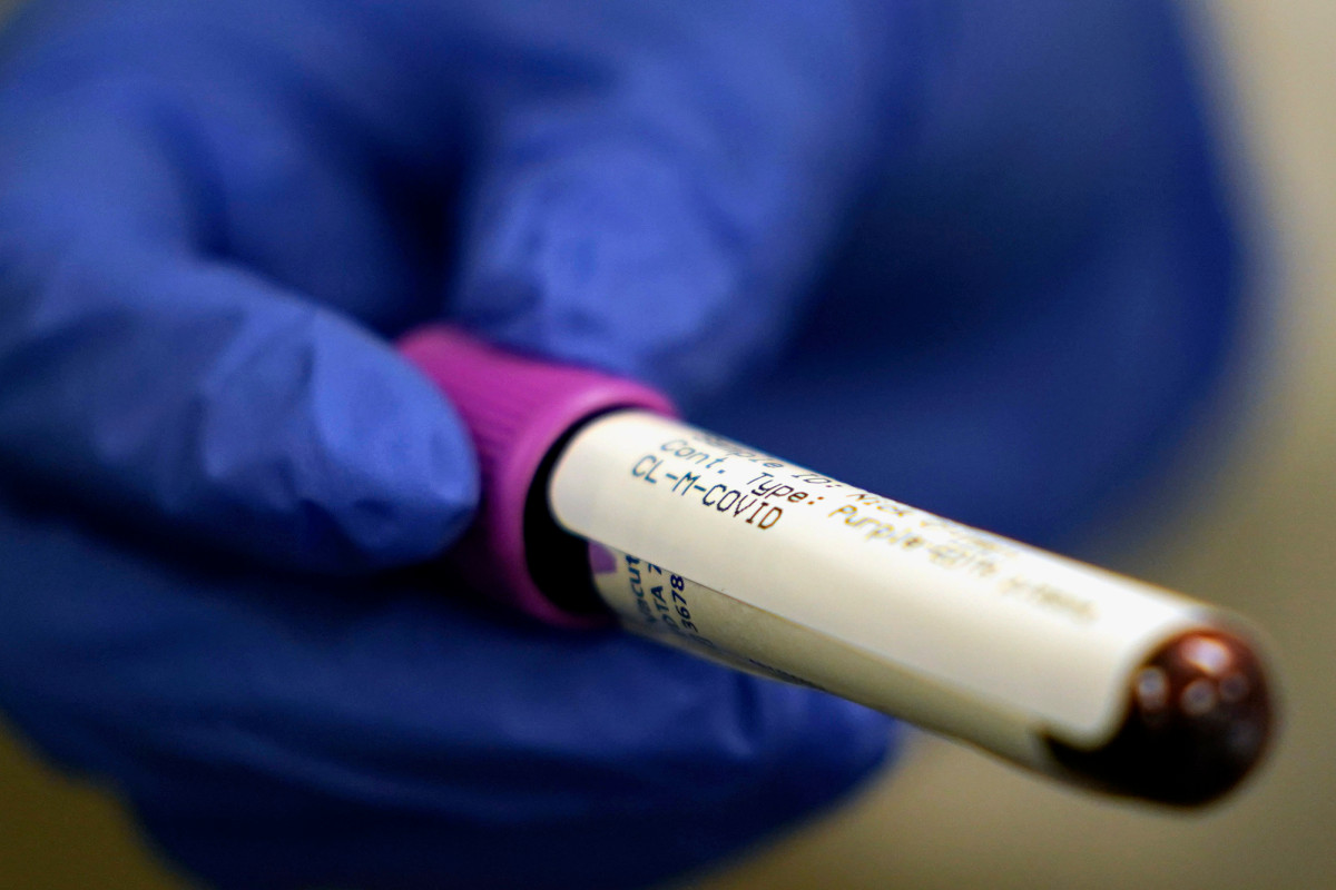 Germ warfare researchers have designed a coronavirus test that they're calling a 'game-changer' trib.al/KeYr9oc