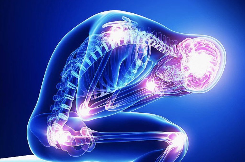 DanLairdMD's tweet photo. Every day, I’m impressed with the selfless behavior of chronic pain patients during times of personal adversity. I don’t think there’s a group of people who’ve been more mistreated &amp; maligned. There are purported ‘healers’ who’ve built academic careers on mistreating CPPs. https://t.co/9dHcazEJwZ